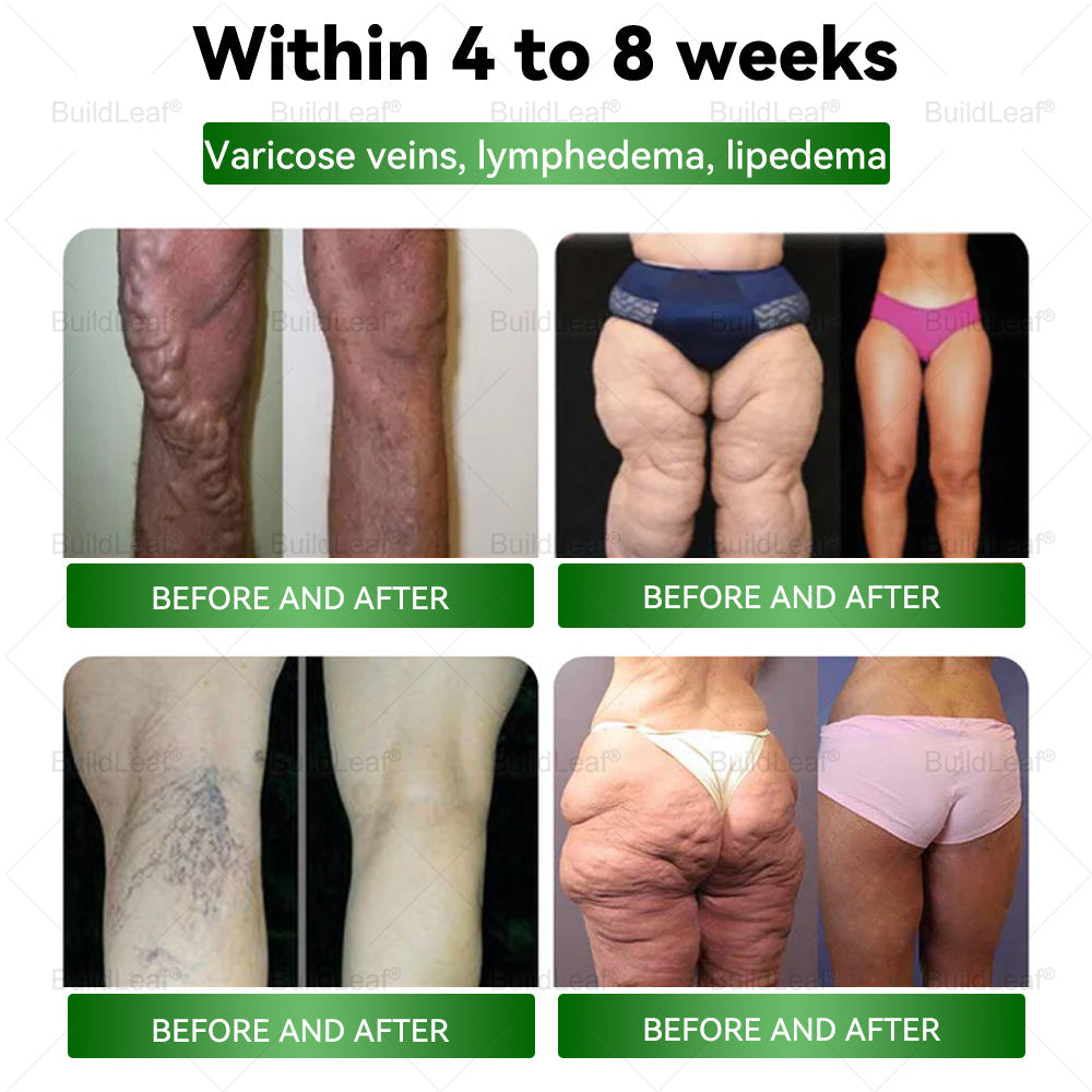 𝐁𝐮𝐢𝐥𝐝𝐋𝐞𝐚𝐟® 💎💎𝐓𝐈𝐑𝐙𝐄𝐏𝐀𝐓𝐈𝐃𝐄 𝐆𝐋𝐏-𝟏 𝐇𝐞𝐫𝐛𝐚𝐥 𝐎𝐫𝐚𝐥 𝐋𝐢𝐪𝐮𝐢𝐝 | 𝐎𝐛𝐞𝐬𝐢𝐭𝐲, 𝐋𝐲𝐦𝐩𝐡𝐞𝐝𝐞𝐦𝐚, 𝐃𝐢𝐚𝐛𝐞𝐭𝐞𝐬, 𝐂𝐚𝐫𝐝𝐢𝐨𝐯𝐚𝐬𝐜𝐮𝐥𝐚𝐫 𝐝𝐢𝐬𝐞𝐚𝐬𝐞, 𝐇𝐢𝐠𝐡 𝐛𝐥𝐨𝐨𝐝 𝐩𝐫𝐞𝐬𝐬𝐮𝐫𝐞, 𝐅𝐚𝐭𝐭𝐲 𝐥𝐢𝐯𝐞𝐫, 𝐚𝐧𝐝 𝐆𝐮𝐭 𝐡𝐞𝐚𝐥𝐭𝐡 𝐢𝐬𝐬𝐮𝐞𝐬