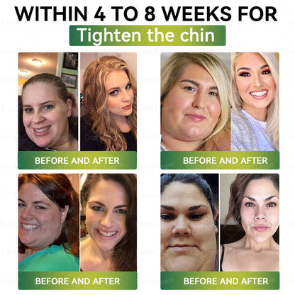 ✨Official Store |✨ CrazyLeaf® Meglutide GLP-1 Activating Oral Solutionwith Collagen & Matrixyl 3000|✨Obesity,Cardiovascular Diseas, Diabetes, Sleep Apnea, Joint Problems and More